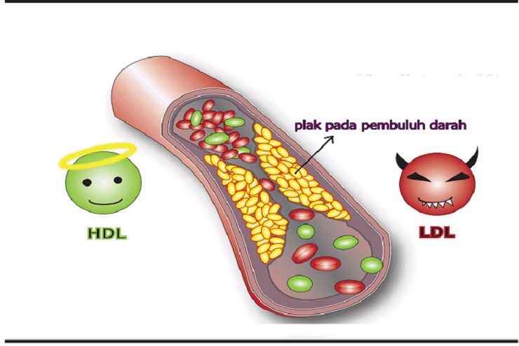Obat Kolesterol Jahat Alami dan Aman
