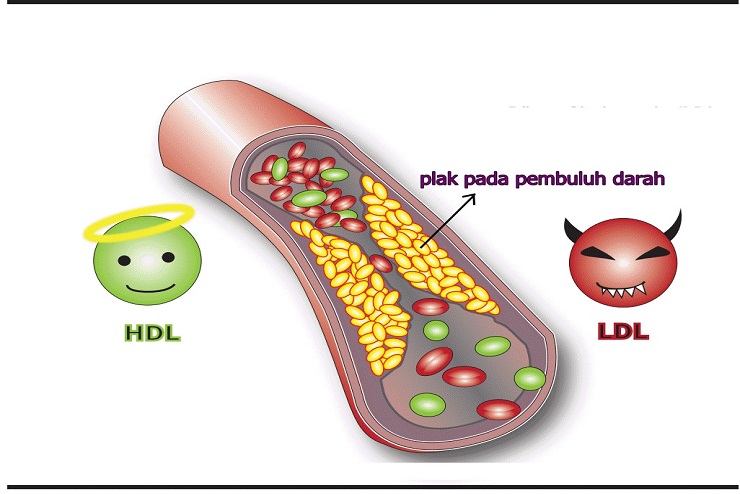 Rekomendasi Obat Kolesterol Paling Ampuh